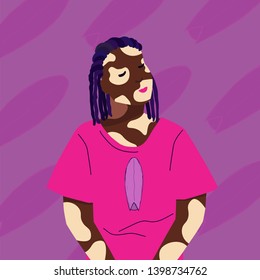 Dark skinned girl with vitiligo and blue dreadlocks.Vector illustration of african american women in oversize t-shirt with surfboard print.Surfs pattern on the background.Flat style.Beauty diversity