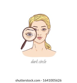 Dark under eye circle bag problem - cartoon blonde woman with magnifying looking glass showing skin condition from stress and insomnia - isolated flat vector illustration.