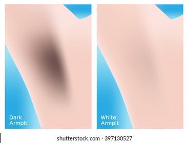 dark and white armpit vector