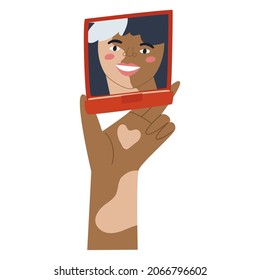 Dark-skinned woman with vitiligo looking at her reflection in a small powder-box mirror.   Flat vector illustration. 