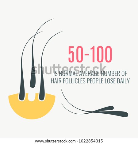Data statistics infographics with receding follicles. Average number of hair loss. Healthcare and beauty treatment. Vector illustration.