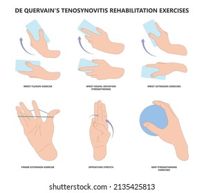 De quervain's pain tendon thumb wrist hurt grasp make a fist sport muscle hand Finkelstein's test bend brace finger strain trigger carpal tunnel brevis Eichhoff's stretch radial Grip spring relief