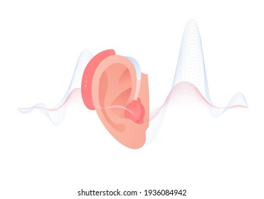 Deaf and hear aid concept. Vector flat illustration. Hearing aid device in human ear with sound wave on background isolated on white. Design element for medicine, health care.