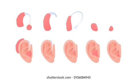 Deaf and hear aid concept. Vector flat illustration set. Collection of hearing aid device inserted into human ear isolated on white. Design element for medicine, health care.