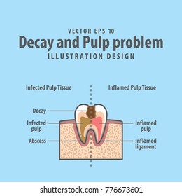 Decay and Pulp problem cross-section structure inside tooth diagram and chart illustration vector on blue background. Dental concept.