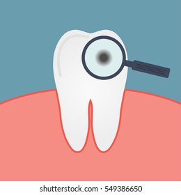 Decay tooth. Caries. Gum, mouth, magnifying glass, enamel disease. The microbe under a microscope. Diagnostics dentist. Vector illustration.