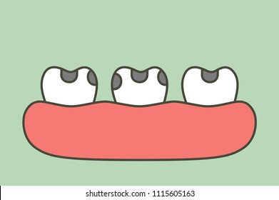 decay tooth or dental caries - teeth cartoon vector flat style cute character for design