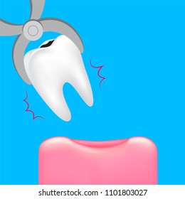 Decay tooth removal. Dental care concept. Illustration isolated on blue background.