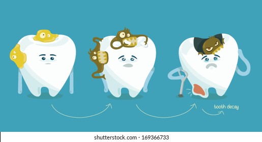 Decay Tooth Step By Step