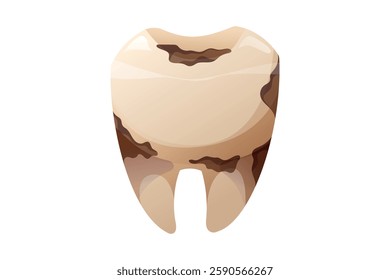 Decayed tooth with cavities and plaque buildup. Damaged molar vector isolated cartoon illustration symbolizing poor oral hygiene, dental problems, and the need for professional treatment.