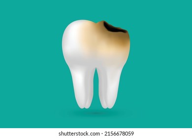 Decayed tooth isolated on green background, Dental caries ,Vector illustration .