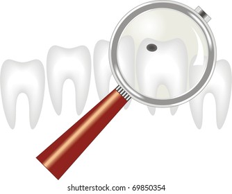 decayed tooth under  magnifying glass ,  dentistry
