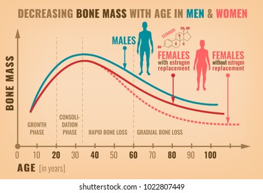 Decreasing Bone Mass With Age In Men And Women. Detailed Infographic In Beige, Pink And Blue Colors. Vector Illustration. Healthcare And Medicine Concept.