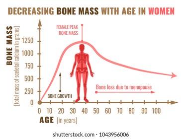 Decreasing Bone Mass With Age In Women. Detailed Infographic In Beige, Brown And Pink Colors Isolated On A White Background. Vector Illustration. Healthcare And Medicine Concept.