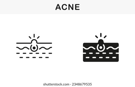 Deep Dirty Pore, Skin Problem Symbol Collection. Skin Acne, Blackhead, Comedo Line and Silhouette Black Icon Set. Pimple and Inflammation Sebum Pictogram. Isolated Vector Illustration.