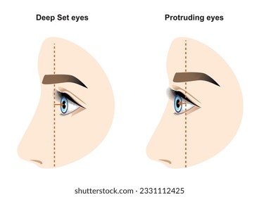 Ojos profundos y sobresalientes. Tipos de ojos. Geometría facial.