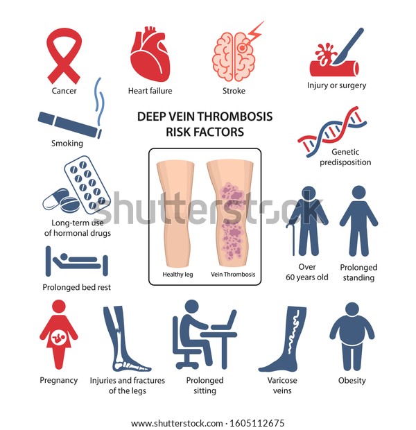 76 Varicose Vein Causes Images, Stock Photos & Vectors | Shutterstock