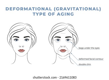 Deformational type of aging on the face. The face of a woman in her youth and old age.