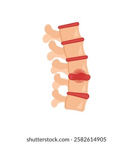 Degenerative, Disorder, Disability Vector Illustration Isolated