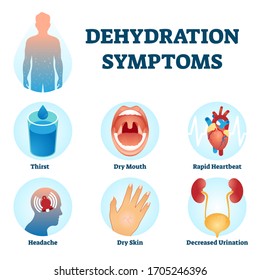 Dehydration Symptoms Vector Illustration. Educational Water Deficit Diagnosis Scheme With Symptoms Collection List. Low Liquid Consumption Medical Condition Infographics. Thirst And Dryness Problem.