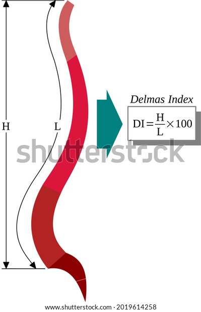 Índice Delmas o relación entre la: vector de stock (libre de regalías ...