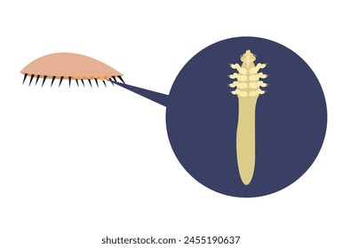 El ácaro facial Demodex causa blefaritis o molestias en los párpados. Arte de Clip editable.