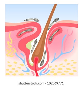 Demodicosis (Demodex), also called demodectic mange or red mange. Vector illustration.