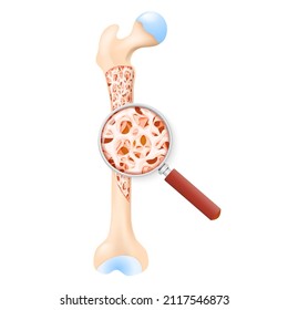 density of a healthy bone. Cross section of human femur. Inside of a bone showing the trabecular structure. Close-up of bone tissue. looking through a magnifying glass. Vector illustration