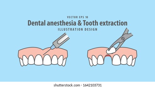 6,316 Anesthesia dental Images, Stock Photos & Vectors | Shutterstock