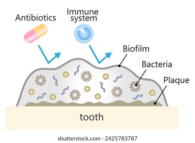 dental biofilm on tooth illustration. dental and oral care concept