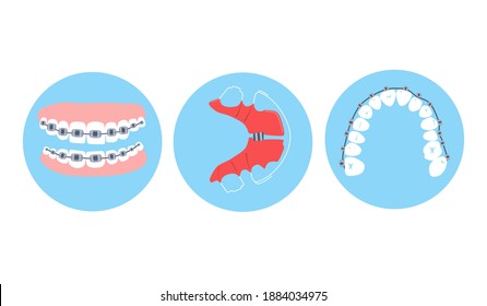 Dental braces, aligner or orthodontic metal retainers on teeth.Oral care and daily routine.Bite correction. Different projections.International day of the dentist.Vector in flat style.Cavity disease