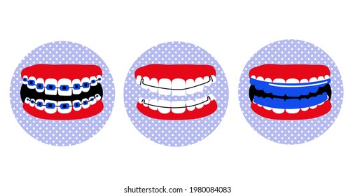 Dental braces, aligner or orthodontic retainer on teeth.Poster in pop art style.Oral care and daily routine.Bite correction.Cavity disease.False jaw.Bruxism treatment.Vector