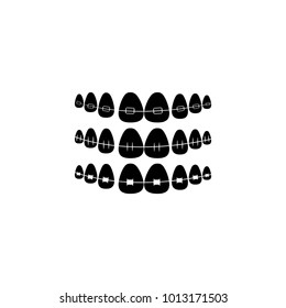 Dental Braces. Ceramic braces.