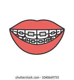 Dental braces color icon. Teeth aligning. Isolated vector illustration