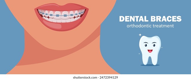 Dental Braces. Happy tooth character. Beautiful smiling mouth with healthy teeth. Orthodontic treatment concept. Horizontal banner. Vector