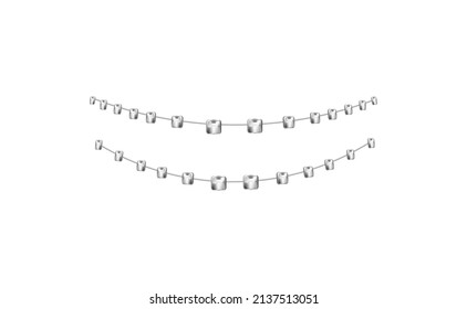 Dental braces for the lower and upper jaw, realistic template vector illustration isolated on white background. Teeth orthodontic silver tone braces on wire.