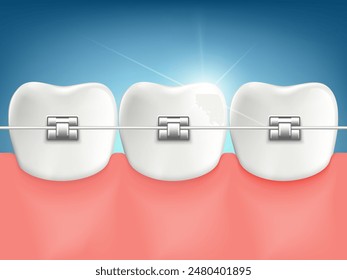 Dental braces on teeth closeup. Stock vector illustration