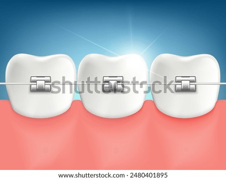 Dental braces on teeth closeup. Stock vector illustration