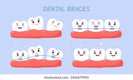 Dental braces set. Dentistry and stomatology, oral hygiene. Health care and medicine, treatment. Dental orthopedics. Cartoon flat vector collection isolated on violet background