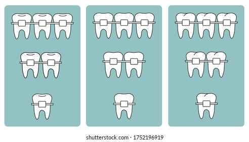Dental braces. Set of icons. Icons for the website.Vector image.
