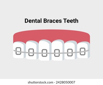 Dental braces teeth flat illustration. Dentistry and orthodontics vector illustration. Dental clinic services, stomatology, dentistry, orthodontics, oral health care and hygiene vector.