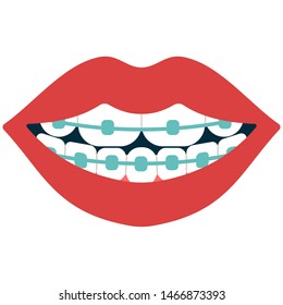 Dental braces vector cartoon illustration isolated on a white background.