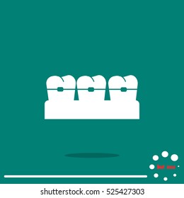 Dental braces vector illustration