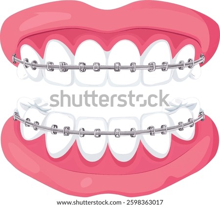 Dental Braces Vector Illustration Isolated on White Background