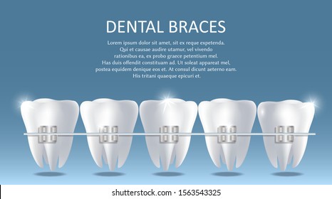 Dental braces vector poster banner template. Realistic white teeth with metal brackets. Orthodontic treatment, bite correction concept.