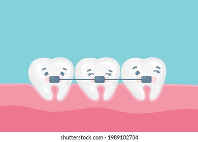 Retainers Braces Stock Vectors, Images & Vector Art | Shutterstock