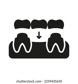 Dental Bridge Silhouette Icon. Tooth Regeneration. Porcelain Denture Glyph Pictogram. Partial Teeth Implant Restoration. Dental Treatment Solid Sign. Dentistry Symbol. Isolated Vector Illustration.