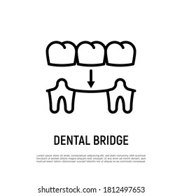 Dental bridge thin line icon. Dentistry, prosthesis. Tooth restoration. Vector illustration.