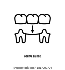 Dental bridge thin line icon. Dentistry, prosthesis. Tooth restoration. Vector illustration.