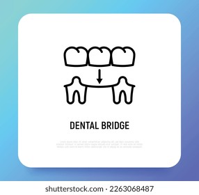 Dental bridge thin line icon. Dentistry, prosthesis. Tooth restoration. Vector illustration.